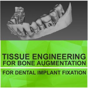 TISSUE ENGINEERING FOR BONE AUGMENTATION FOR DENTAL IMPLANT FIXATION